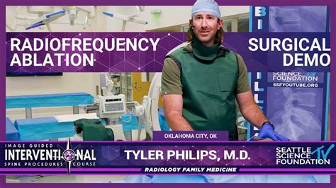 Radiofrequency Ablation Tyler Phillips M D Youtube