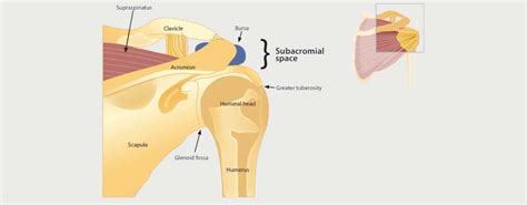 Shoulder Impingement Motus Physical Therapy