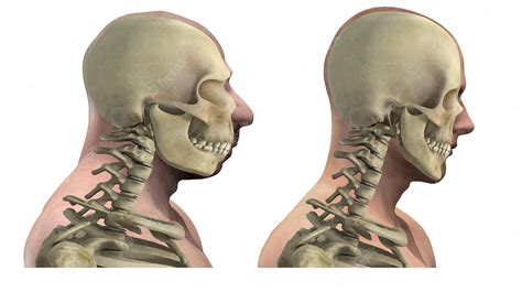 Neanderthal Skeleton Vs Modern Human