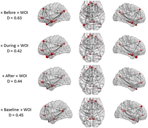 Maps Of Dmn Intrinsic Connectivity In The Tle Group The Node Sizes Download Scientific Diagram