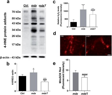 A Western Blotting Analysis Of 4 Hne Protein Adducts In Normal Muscle Download Scientific