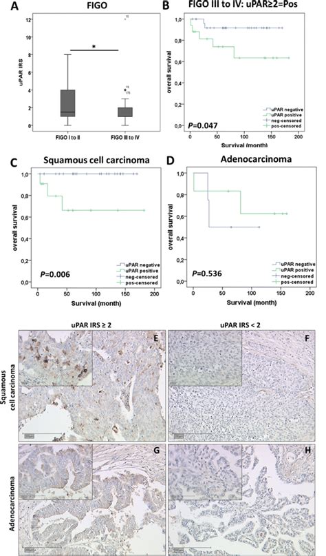 The Expression Of Urokinase Type Plasminogen Activator Receptor Upar