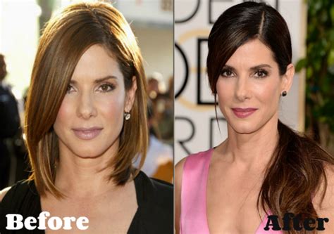 5 A Listers That Got Botox And Are All The Better For It Cool Buzz