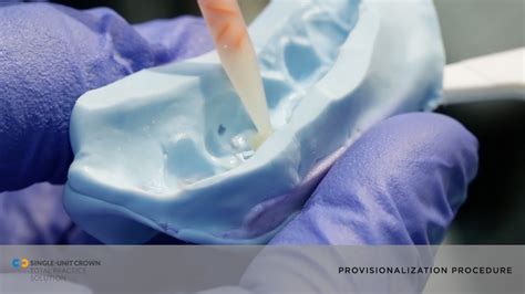 See The Provisional Procedure Of A Single Unit Crown Dental Restoration