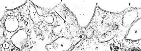 Urothelium 1 – Collection of Histology Images