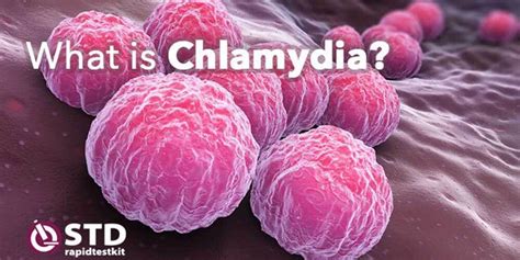 Chlamydia Symptoms Images