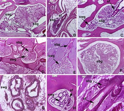 Sudoriferous Glands Histology