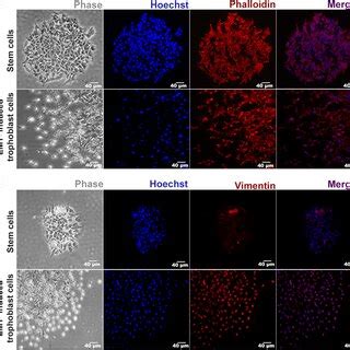 Phenotypic Characterization Of Ts Cells Upon Emt Induction A