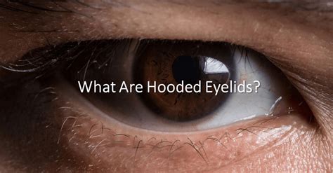 What Are Hooded Eyelids Dream Plastic Surgery