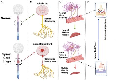 Frontiers Mechanism Of Skeletal Muscle Atrophy After Spinal Cord