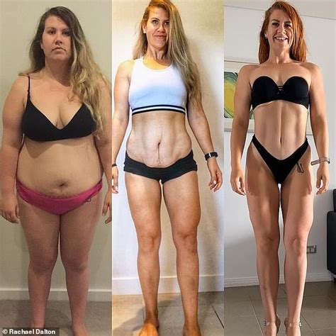 Rachael Dalton Who Weighed 127 Kilos Dramatically Drops 50 Kilos