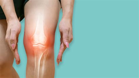 5 Warning Signs Of Knee Arthritis You Should Not Ignore Onlymyhealth