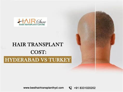 Hair Transplant Cost Hyderabad Vs Turkey Cyber Hairsure