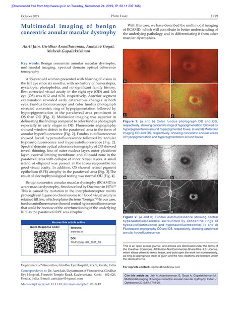 PDF Multimodal Imaging Of Benign Concentric Annular Macular Dystrophy