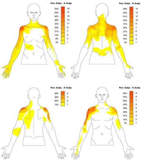 Frozen Shoulder Pain Location at Mark Byrd blog