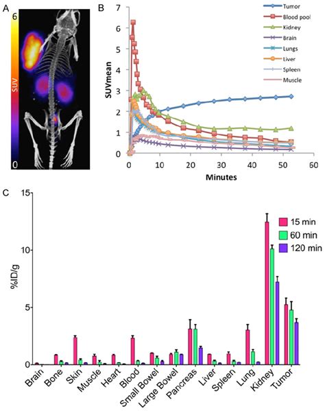 A Representative 3D MIP Reconstruction Of 68 Ga DOTATOC PET CT Of