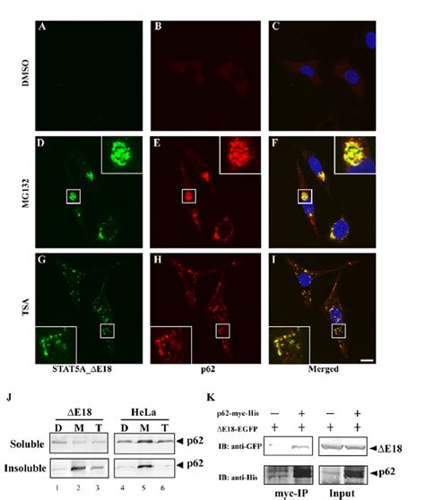 P62 Positive Aggresome Formation A I Hela Cells Stably Expressing