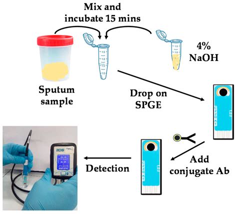 Sputum Sample