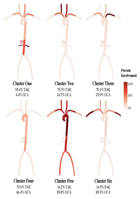 Comparison of Arterial Patterns of Disease in Takayasu’s Arteritis and ...