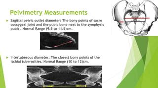 Pelvimetry | PPT