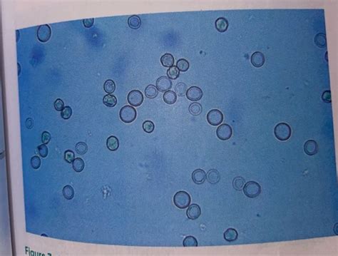 Urinalysis Image Quiz Flashcards Quizlet