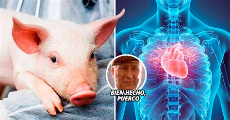 Éxito Primer trasplante de corazón de un cerdo a un humano