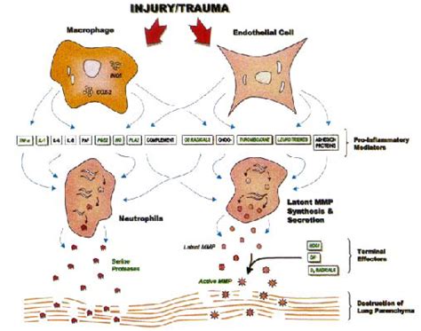 The Systemic Inflammatory Response Syndrome That Results In Ards