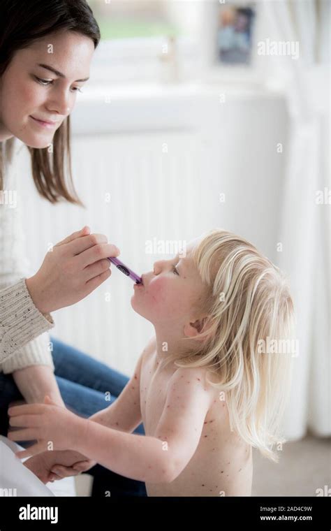 El Tratamiento De La Madre Hija Con Varicela A O Vieja Madre Dando