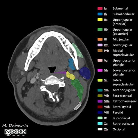 Ct Anatomy Of Neck - Anatomical Charts & Posters