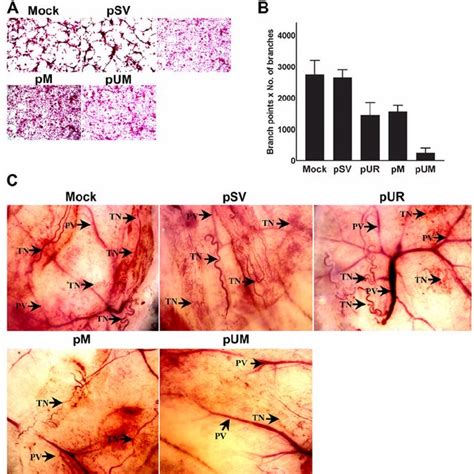 Targeting Upar And Mmp Through Rnai Treatment Reduced Angiogenesis