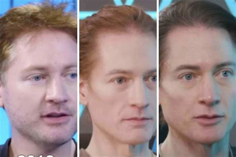 Tech Billionaire Bryan Johnsons Anti Ageing Transformation Pictures