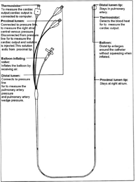 Figure 5 From Approach To Swan Ganz Thermodilution Catheter Complications 6 Years Experience