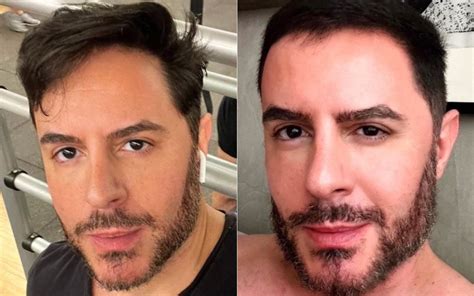 Antes E Depois De Ricardo Tozzi Confunde A Web O Que Aconteceu Aqui