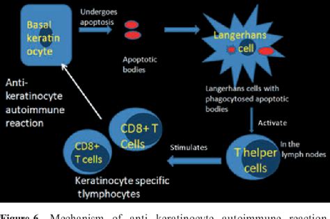 Figure 2 From Pathogenesis Of Oral Lichen Planus A Review Semantic Scholar