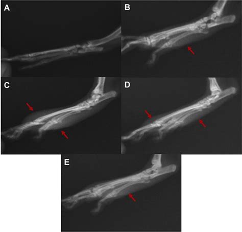 Investigation Of The Anti Inflammatory Effects Of Caffeic Acid