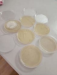 Amazon Fumete Pcs Prepoured Agar Plates Kit Includes Petri