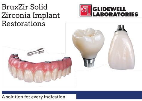 Product Profile Glidewell Dental Dentaltown