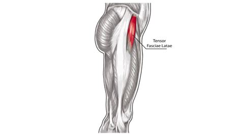 Tensor Fasciae Latae Pain