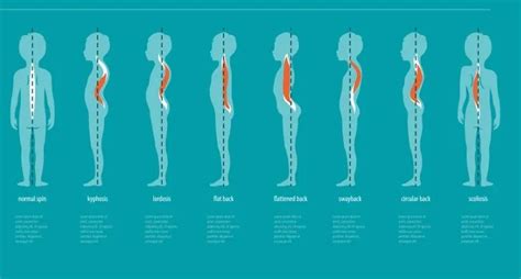 La Influencia De La Postura En El Equilibrio Y La Biomec Nica Del