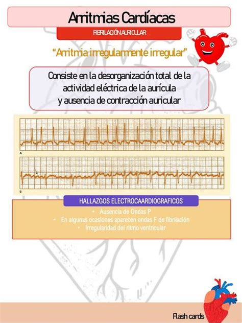 Arritmias Cardiacas Felipe Campos Udocz