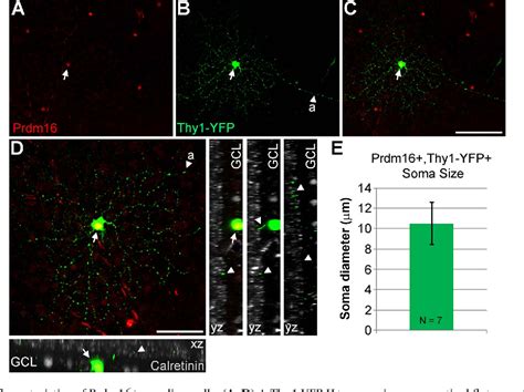 Figure From The Transcription Factor Prdm Marks A Single Retinal