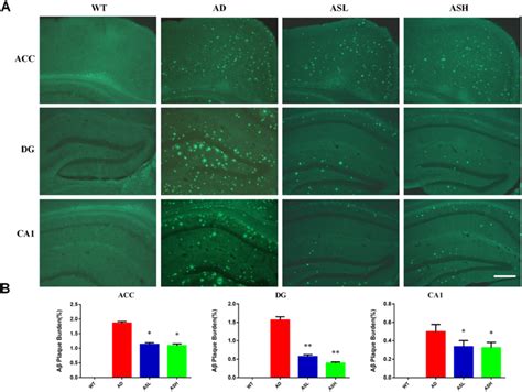 As Iv Reduces The Production Of A Plaques In Xfad Mice A Tissue