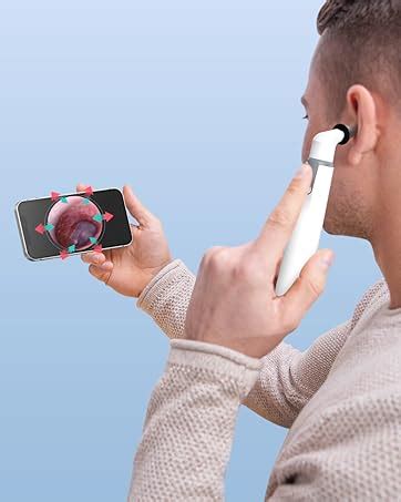 Amazon Anykit Usb C Digital Otoscope For Type C Phone Tablet