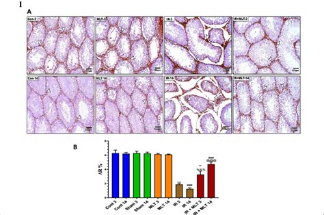 I A Immunoassay Of Androgen Receptor Ar In The Testis Of The Control Download Scientific