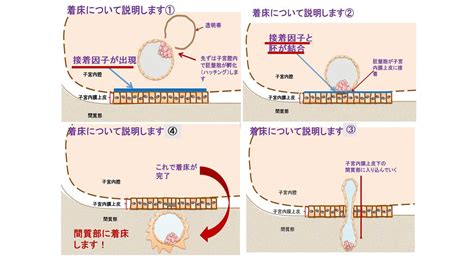 新鮮胚移植採卵数が多い場合は何故、妊娠率が下がるのか？ よくあるご質問徐クリニック