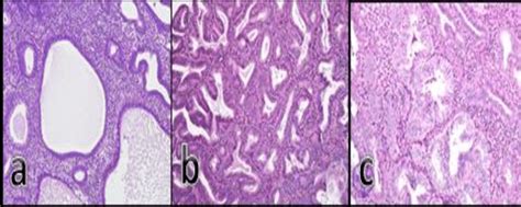 Hande Stained Sections Of Endometrial Tissue A Simple Endometrial Download Scientific Diagram