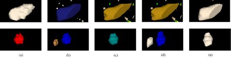 Figure 3 From Rib Fracture Segmentation Based On 3D FM Unet Semantic