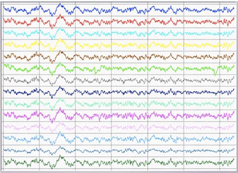 Set Of Signals Derived From An Electroencephalogram Eeg Fourteen