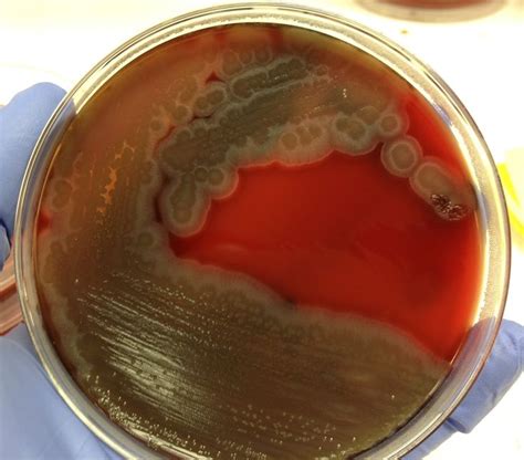 Bacillus On BAP Medical Laboratory Science Microbiology Laboratory