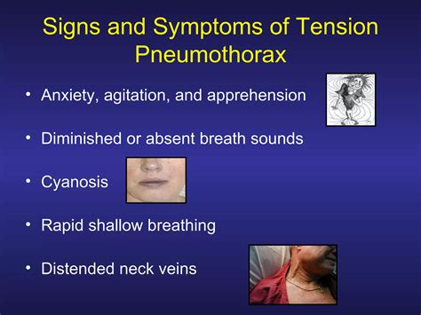 Treating Penetrating Chest Trauma PPT